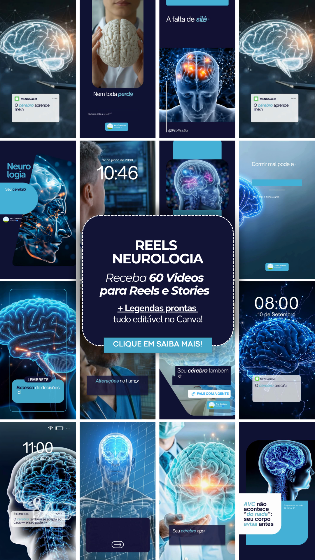 REELS NEUROLOGIA
